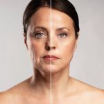 LED light therapy face lift before after anti-aging results on mature skin showing improved firmness and tone