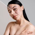 LED light therapy face lift before after showing enhanced skin texture radiance and improved tone