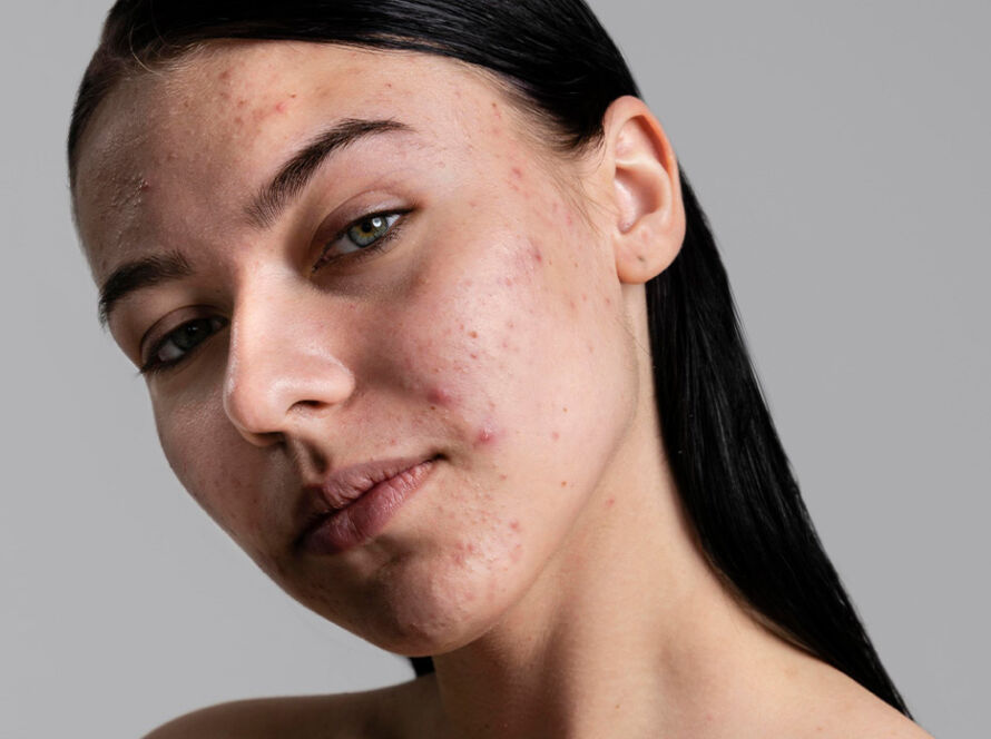 From Acne to Aging: How FiberLift LED Light Supports Every Skin Goal